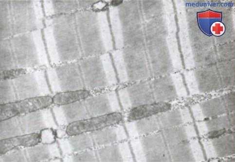 строение мышечного волокна