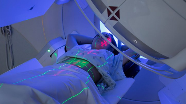 Лимфома Беркитта