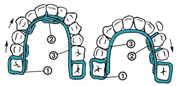 С какими патологиями справляется аппарат Мершона