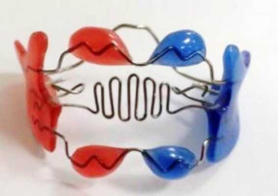 Как работает аппарат Френкеля четвертого типа