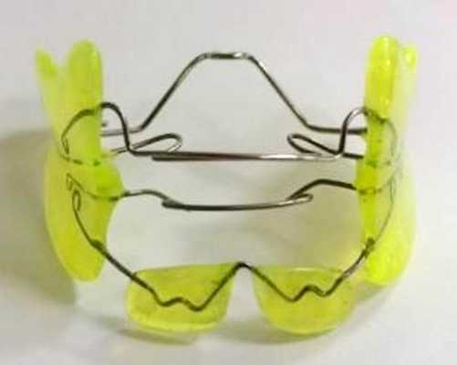 Чем отличается аппарат Френкеля второго типа