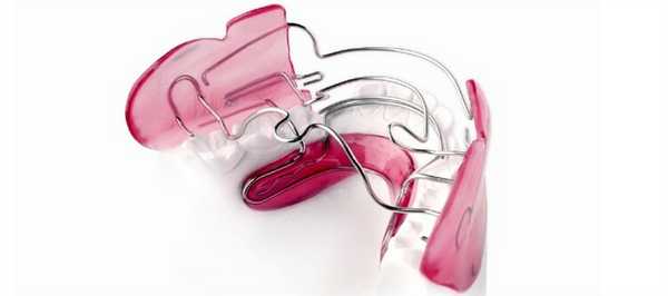 Особенности аппарата Френкеля