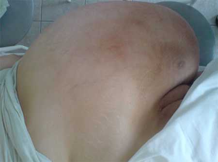 Фото №1 (при госпитализации, вид на боку лежа).