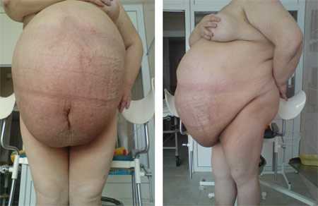 Фото №2, 3 (при гоcпитализации).