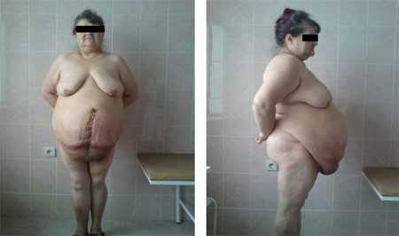 Фото №8 (5-е сутки после операции).