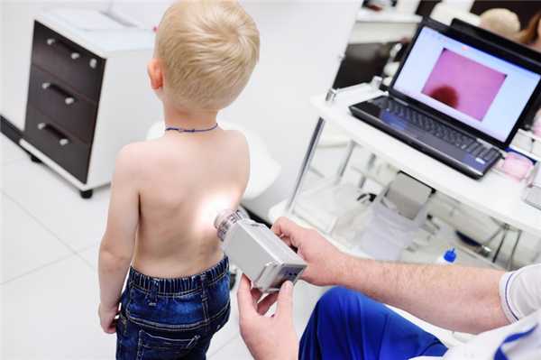 Как лечится нейрофиброматоз, уход за кожей