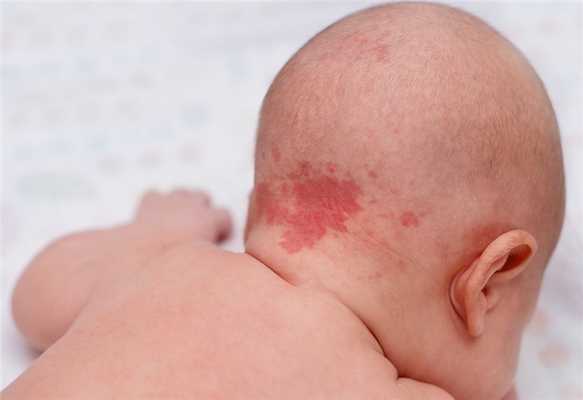 Диагностика болезни: внешний осмотр, тактика врача