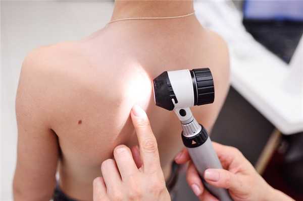 Виды нейрофиброматоза у ребёнка