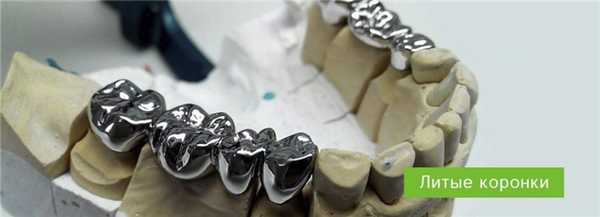 Литые коронки