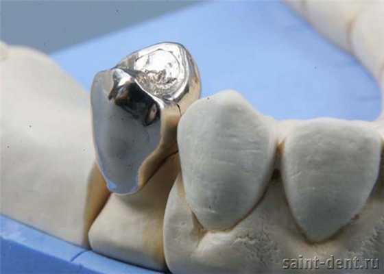 Протезирование цельнолитой коронкой