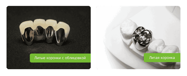 цельнолитные коронки