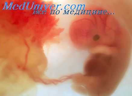 плоды паразиты