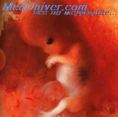 плод паразит