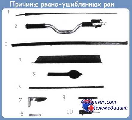 причины рвано-ушибленных ран