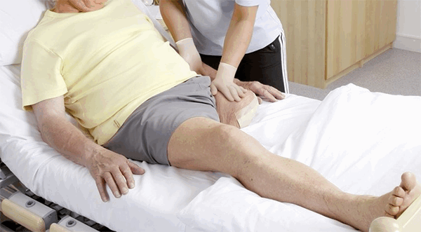 Реабилитация после ампутации конечностей