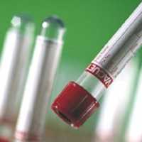 Норма ХГЧ при беременности. Таблица значений ХГЧ по неделям. Повышенный ХГЧ. Низкий ХГЧ. ХГЧ при внематочной беременности. ХГЧ при ЭКО (ХГЧ после подсадки, ХГЧ на 14 дпп). 