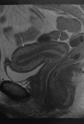 Снимки МРТ и КТ. Анатомия матки и влагалища
