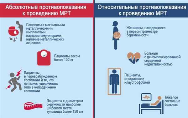 МРТ брюшной полости