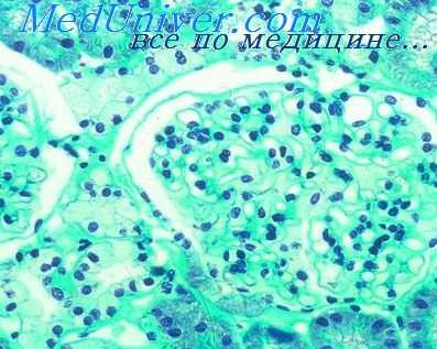 облучение америцием