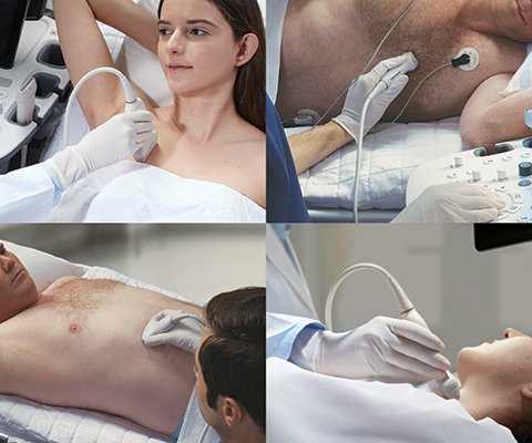 Подвижная граница в полости дивертикула