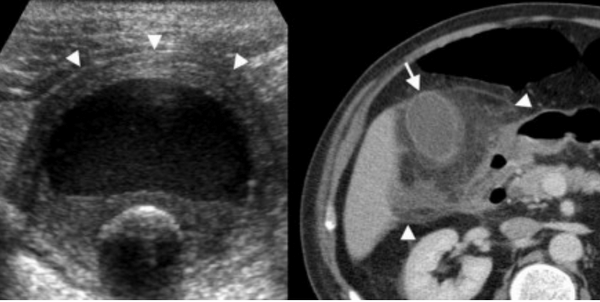 Снимок экрана 2016-04-20 в 21.53.10