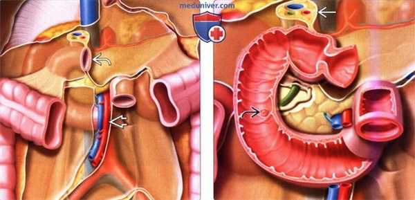 Лучевые методы обследования двенадцатиперстной кишки