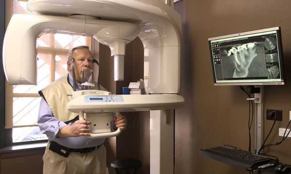 Конусно-лучевая компьютерная томография (КЛКТ)