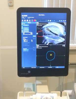 Фьюжн-биопсия. Мастер-класс в НМИЦ онкологии им. Н.Н. Петрова