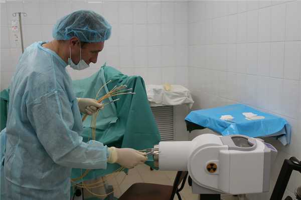 Высокомощностная (высокодозная) брахитерапия