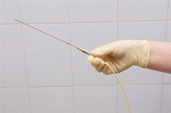 Брахитерапия