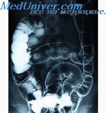 рентгенограммы печени