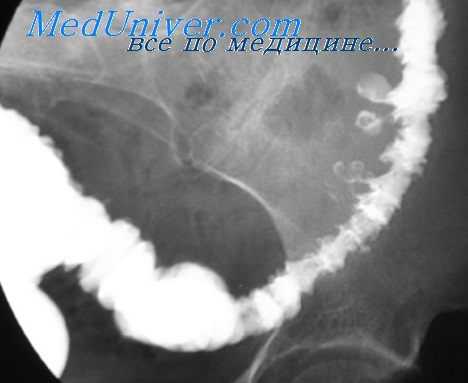 исследование желудка