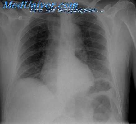 исследование печени