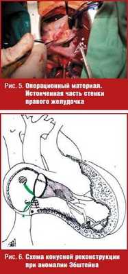 Операционный материал