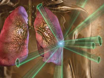 лучевое оражение легких как не допустить