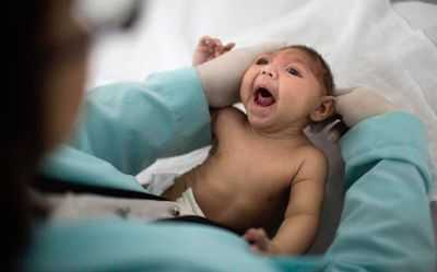 Микроцефалия у ребёнка