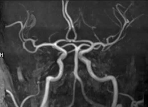 МРТ головы, что показывает