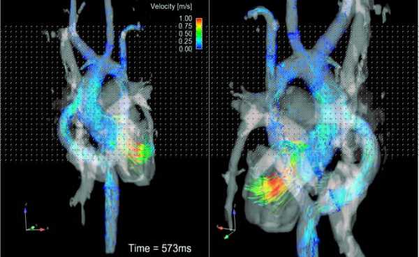 3D-изображение МРТ сердца