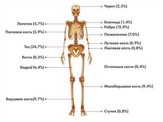 Локализация первичной опухоли саркомы Юинга