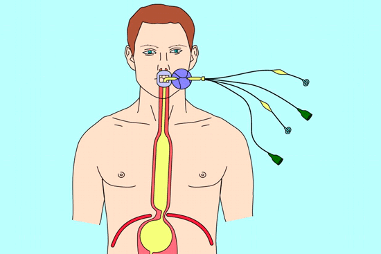 Опухоль пищевода: опасности и решения