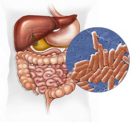 Заболевание, вызываемое различными серотипами бактерий рода Salmonella