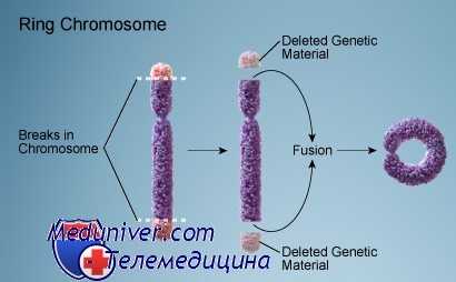 кольцевые хромосомы