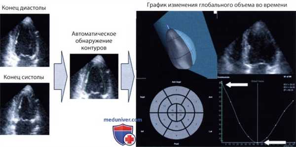 Трехмерная эхокардиография: технические аспекты