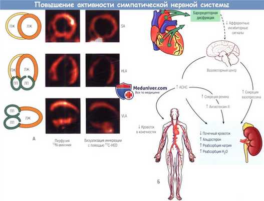 Повышение активности симпатической нервной системы