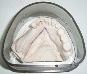 Дублирование рабочей модели полиуретаном