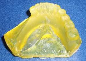 Полиуретановая модель