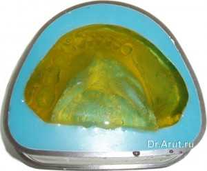 Отливка модели из полиуретана