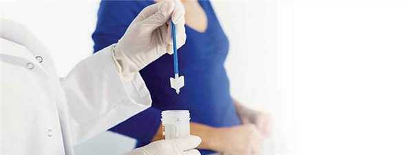 Как берется мазок на флору у женщины