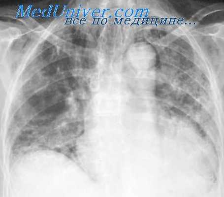 дыхательная функция