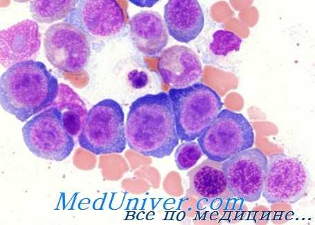 мегалобластная анемия
